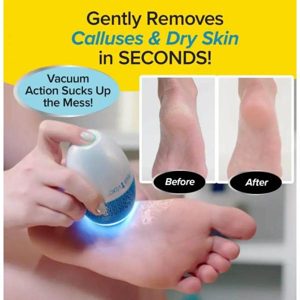 Electric Foot Callus Remover, Rechargeable