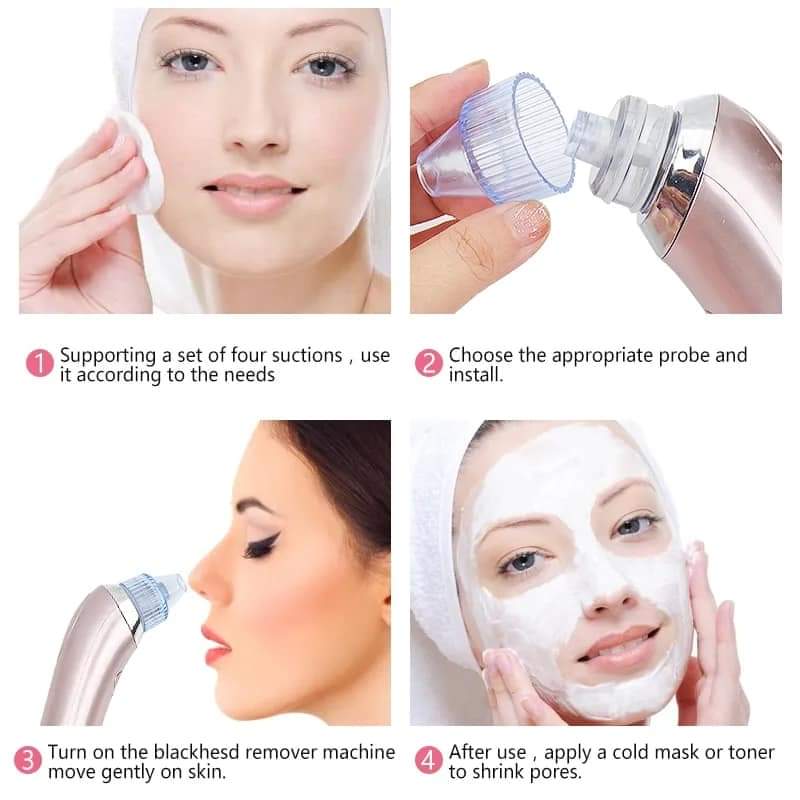 Facial Blackhead Remover